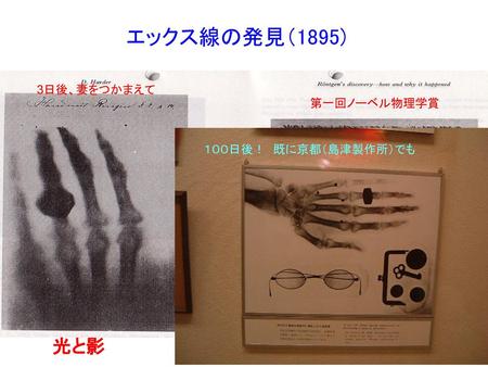 エックス線の発見（1895) 3日後、妻をつかまえて 第一回ノーベル物理学賞 １００日後！　既に京都（島津製作所）でも 光と影.