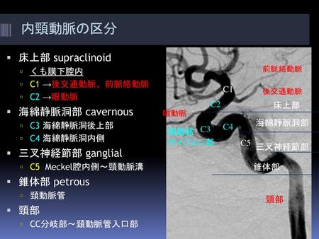 内頸動脈の区分 床上部 supraclinoid 海綿静脈洞部 cavernous 三叉神経節部 ganglial 錐体部 petrous