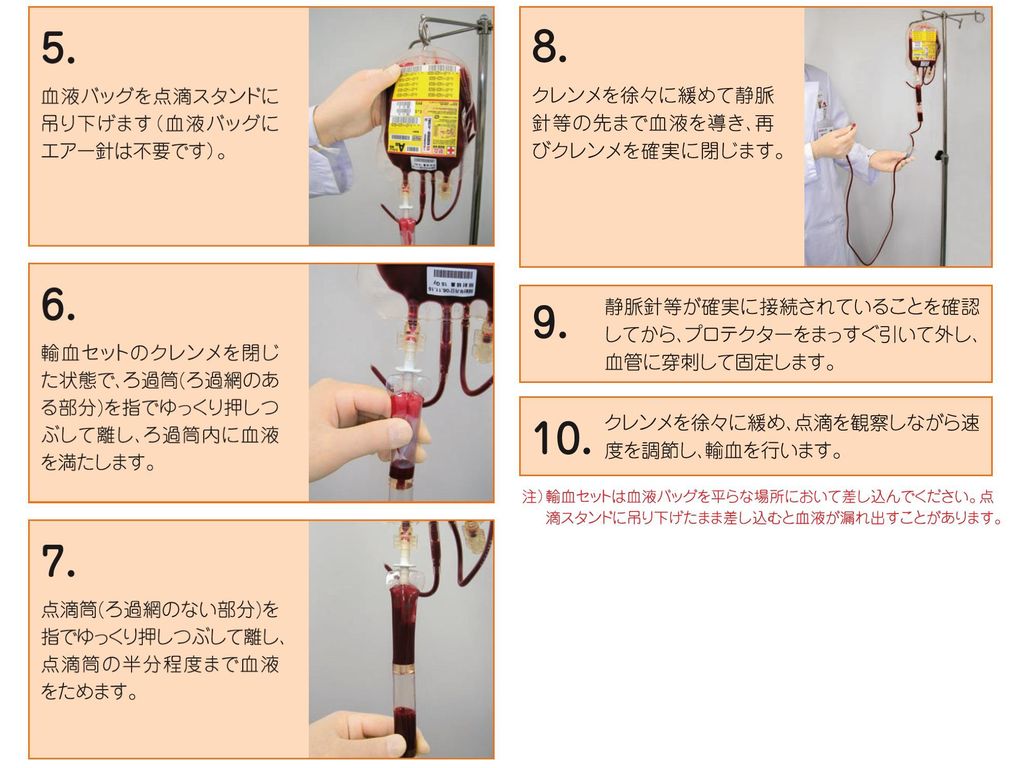 輸血 ルート