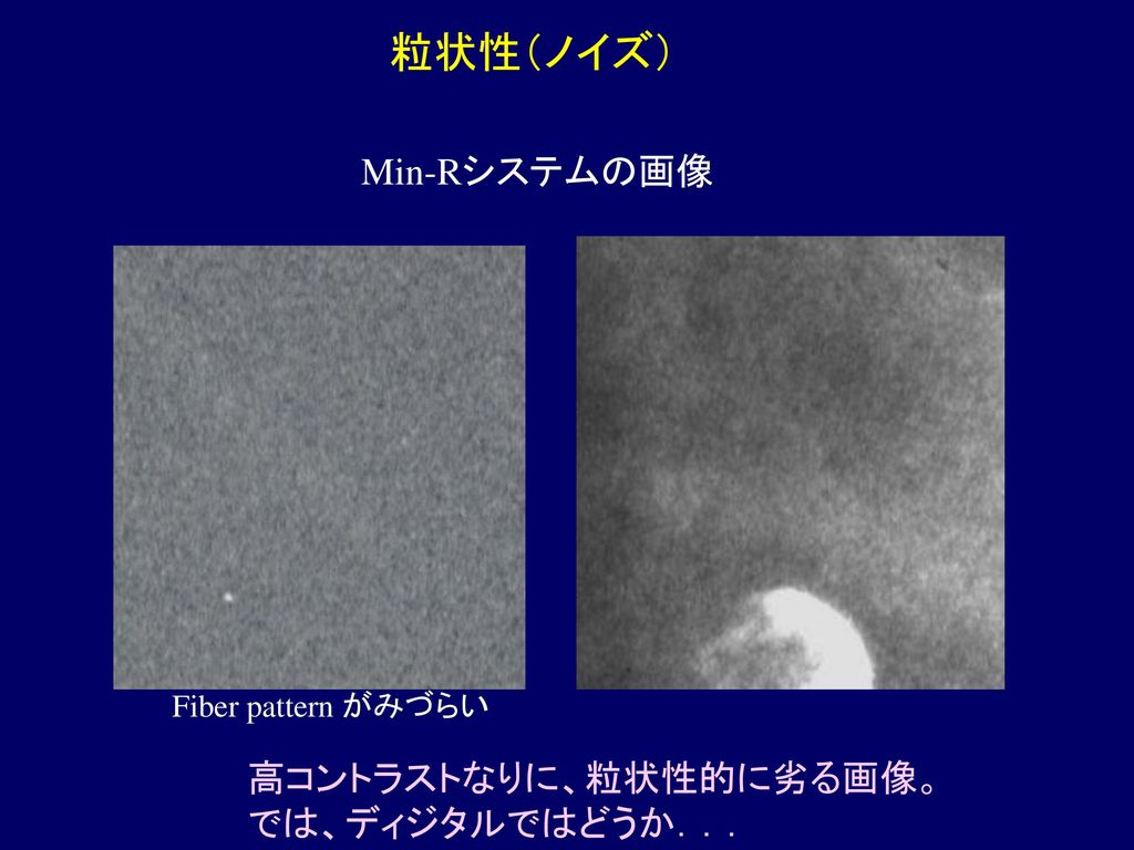 粒状性（ノイズ） Min-Rシステムの画像 高コントラストなりに、粒状性的に劣る画像。 では、ディジタルではどうか．．．