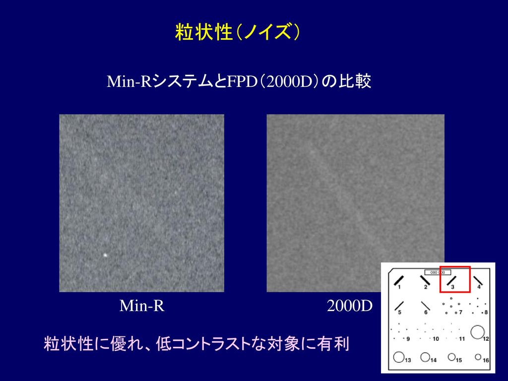 粒状性（ノイズ） Min-RシステムとFPD（2000D）の比較 Min-R 2000D 粒状性に優れ、低コントラストな対象に有利