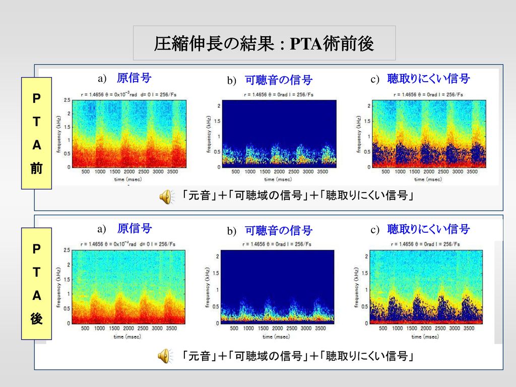 圧縮伸長の結果 : PTA術前後 P T A 前 P T A 後 a) 原信号 b) 可聴音の信号 c) 聴取りにくい信号