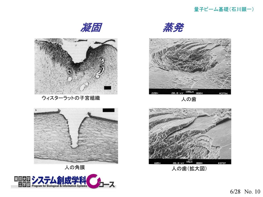 凝固 蒸発 ウィスターラットの子宮組織 人の歯 人の角膜 人の歯（拡大図）