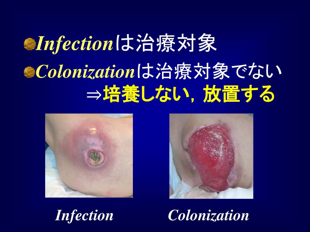 Infectionは治療対象 Colonizationは治療対象でない ⇒培養しない，放置する Infection Colonization