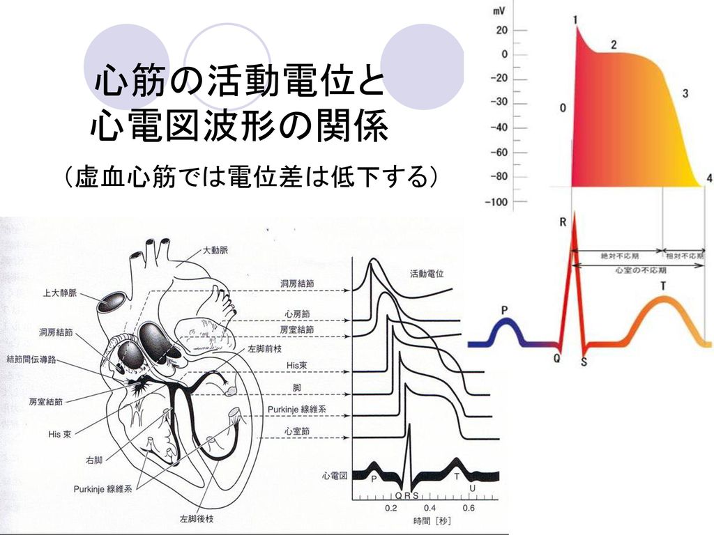 心筋の活動電位と 心電図波形の関係 （虚血心筋では電位差は低下する）