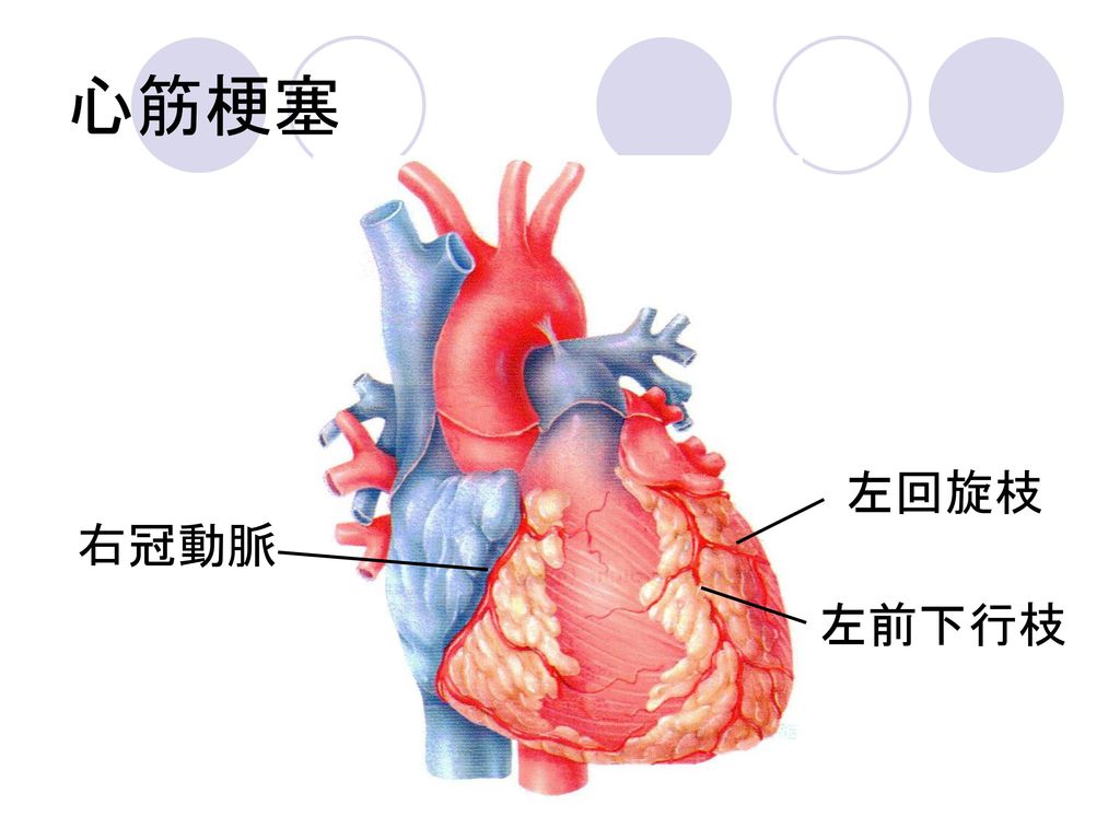 心筋梗塞 左回旋枝 右冠動脈 左前下行枝