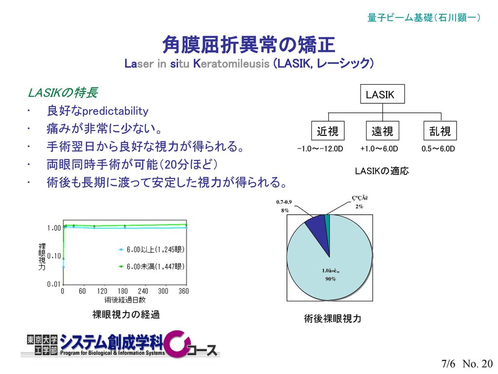 角膜屈折異常の矯正 Laser in situ Keratomileusis (LASIK, レーシック)