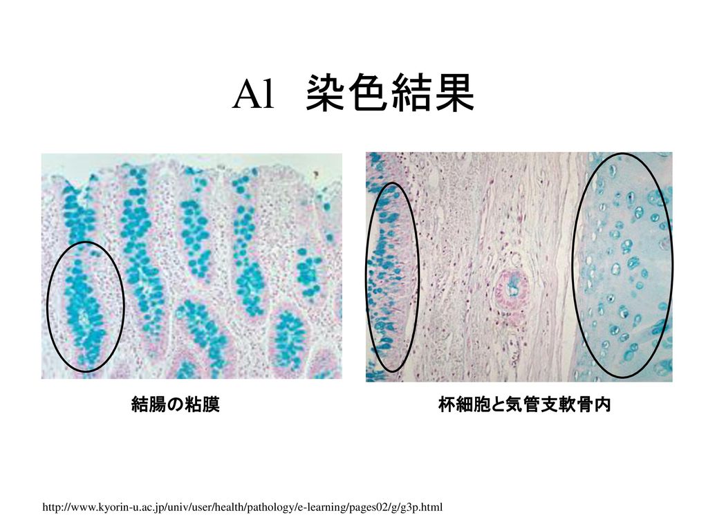 Al 染色結果 結腸の粘膜 杯細胞と気管支軟骨内 左：結腸の粘膜（杯細胞）から産生されている酸性粘液