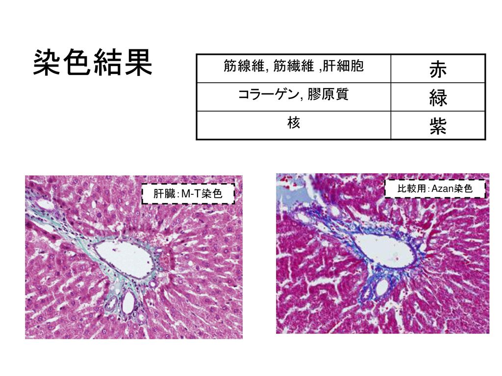 染色結果 赤 緑 紫 筋線維, 筋繊維 ,肝細胞 コラーゲン, 膠原質 核 肝臓：M-T染色 比較用：Azan染色