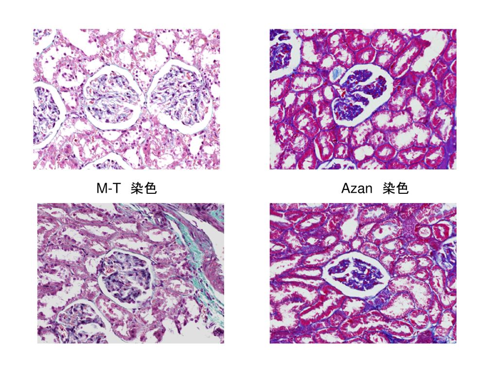M-T 染色 Azan 染色 核がはっきりと染まって見える。
