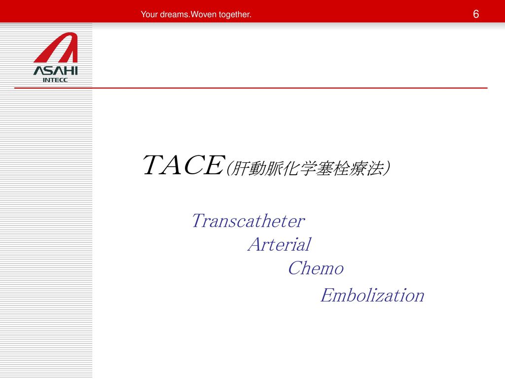 ＴＡＣＥ（肝動脈化学塞栓療法） Transcatheter Arterial Chemo Embolization