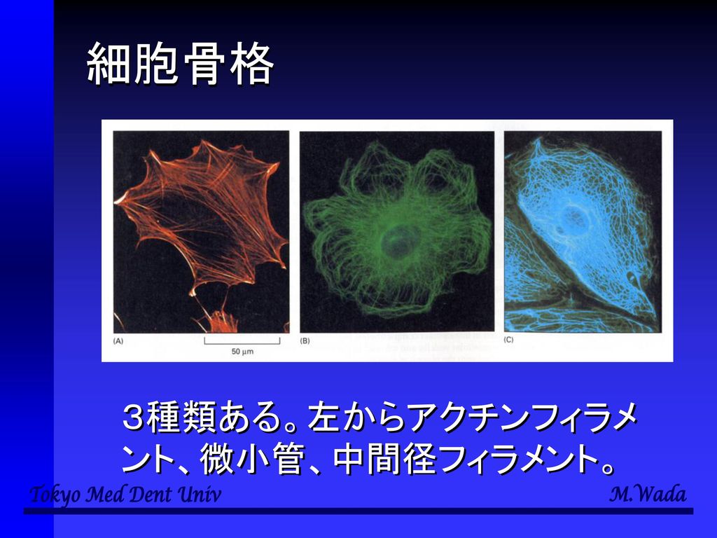 細胞骨格 ３種類ある。左からアクチンフィラメント、微小管、中間径フィラメント。