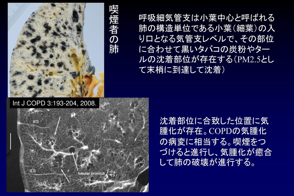 タバコを吸って変わること 豊かさ こころと体 寿命 禁煙で健康なまちづくりを タバコの煙のないお店でおいしく食べたい Ppt Download