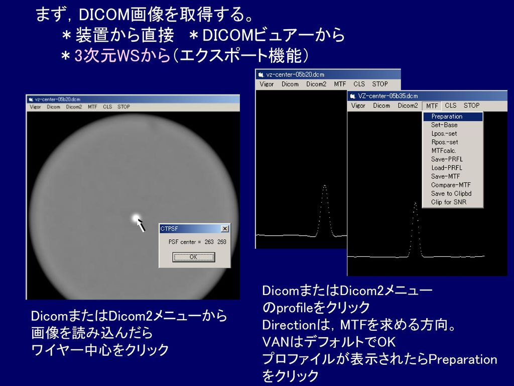 まず，DICOM画像を取得する。 ＊装置から直接 ＊DICOMビュアーから ＊3次元WSから（エクスポート機能）