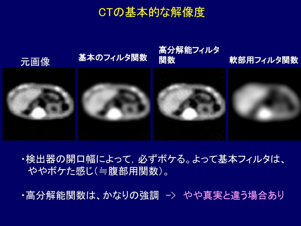 CTの基本的な解像度 元画像 ・検出器の開口幅によって，必ずボケる。よって基本フィルタは、 ややボケた感じ（≒腹部用関数）。