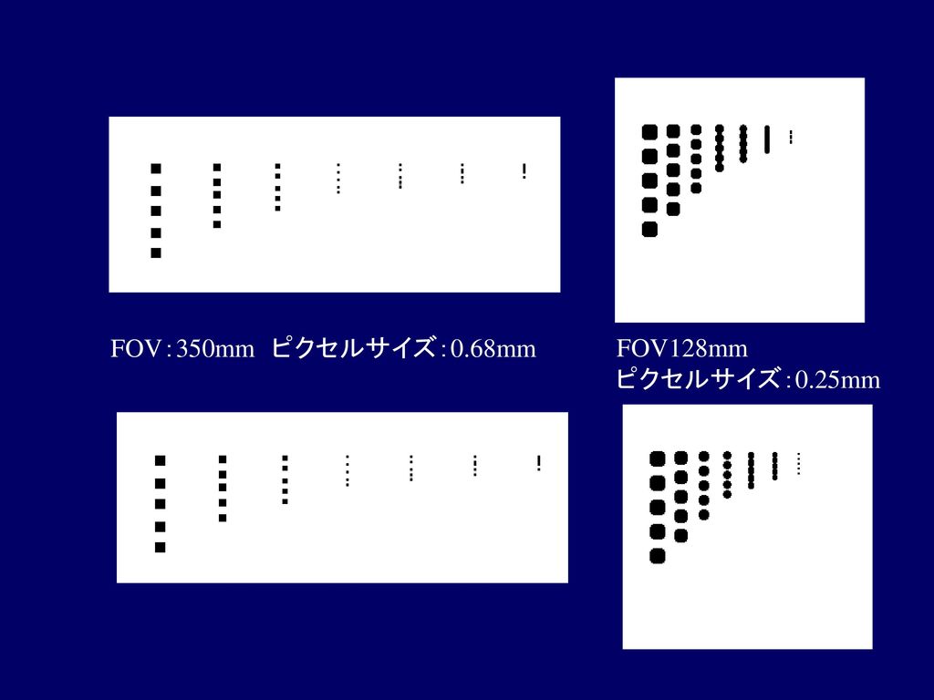 FOV：350mm ピクセルサイズ：0.68mm FOV128mm ピクセルサイズ：0.25mm