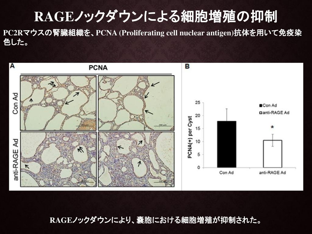 RAGEノックダウンによる細胞増殖の抑制 RAGEノックダウンにより、嚢胞における細胞増殖が抑制された。