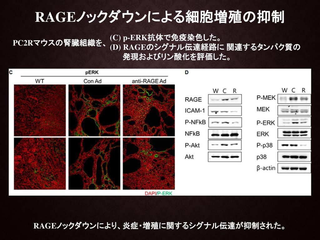 RAGEノックダウンによる細胞増殖の抑制 RAGEノックダウンにより、炎症・増殖に関するシグナル伝達が抑制された。