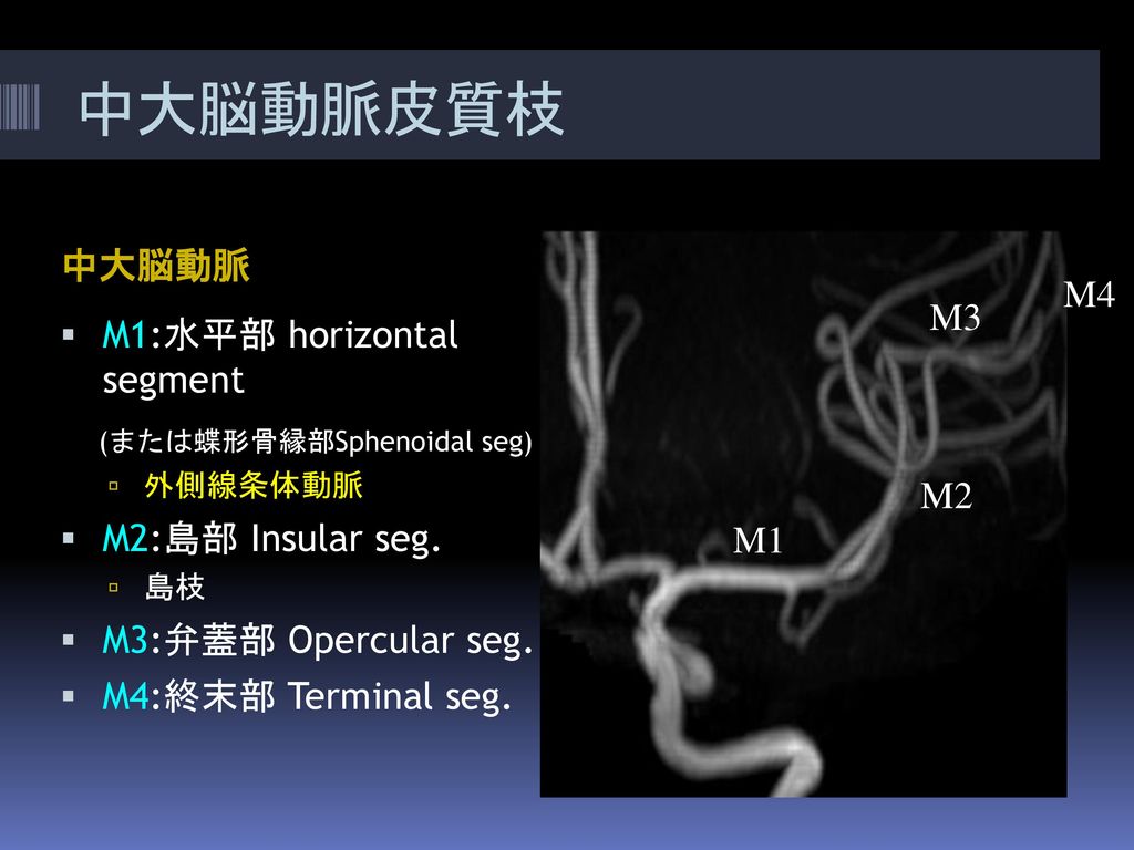 中大脳動脈皮質枝 中大脳動脈 M4 M3 M1:水平部 horizontal segment