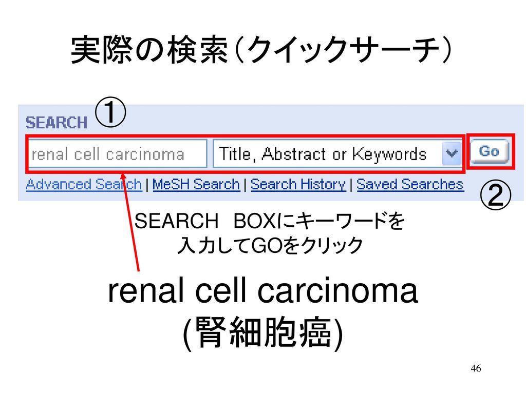 renal cell carcinoma (腎細胞癌) 実際の検索（クイックサーチ） ① ② SEARCH BOXにキーワードを