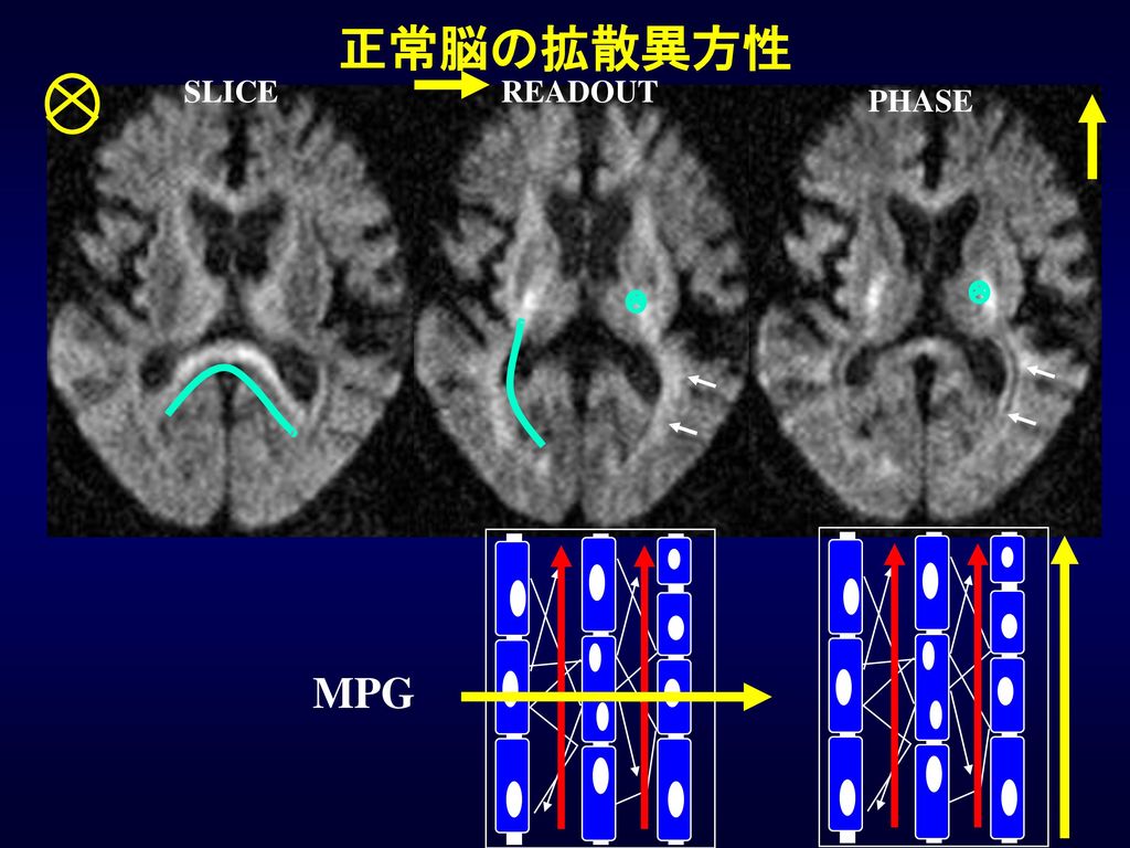 正常脳の拡散異方性 SLICE READOUT PHASE MPG