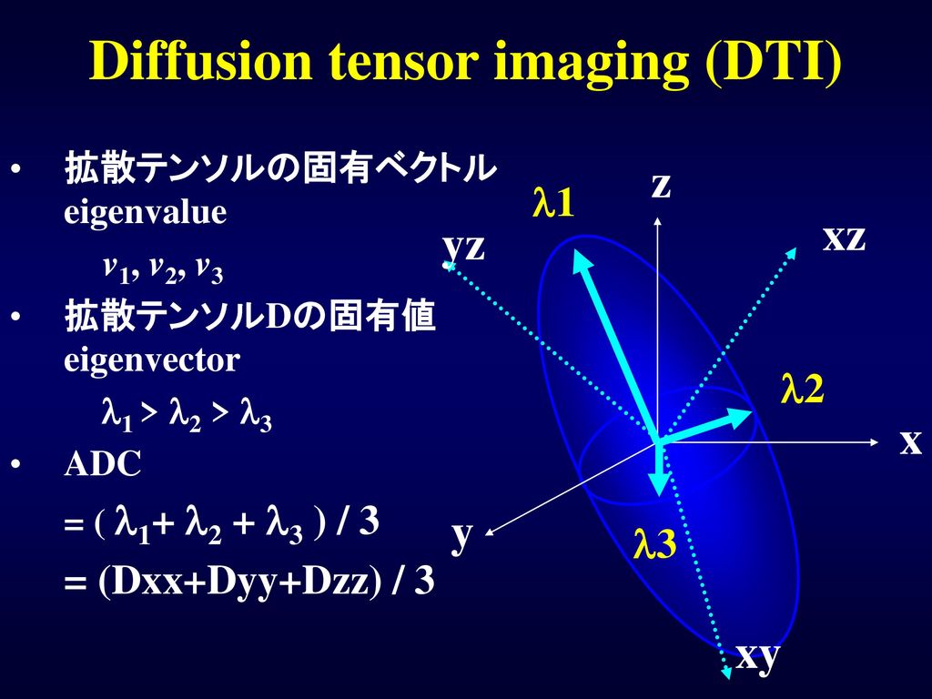 Diffusion tensor imaging (DTI)