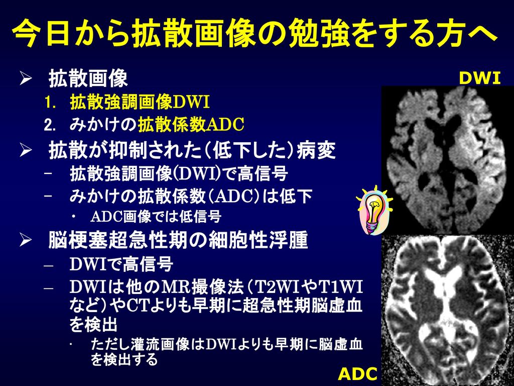 今日から拡散画像の勉強をする方へ 拡散画像 拡散が抑制された（低下した）病変 脳梗塞超急性期の細胞性浮腫 DWI 拡散強調画像DWI