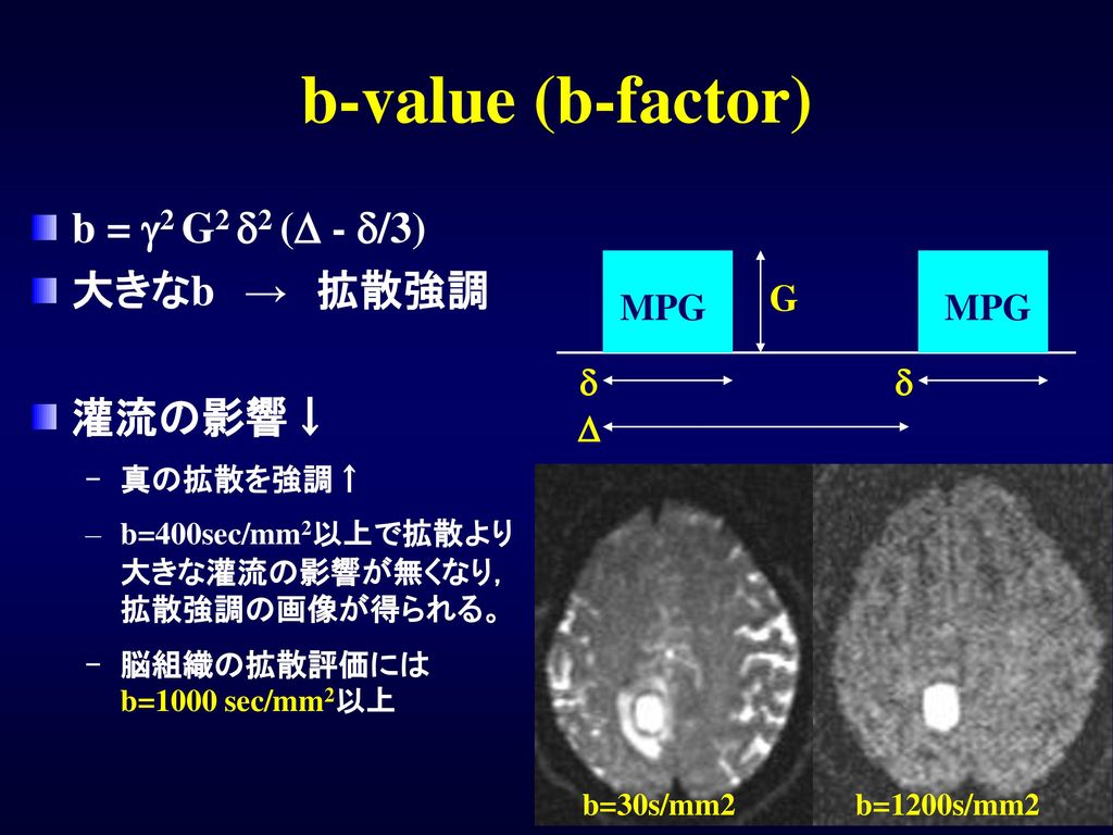 b-value (b-factor) b = g2 G2 d2 (D - d/3) 大きなb → 拡散強調 灌流の影響↓ G MPG d D