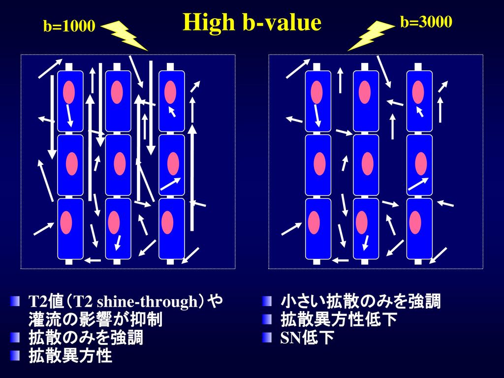 High b-value b=3000 b=1000 T2値（T2 shine-through）や灌流の影響が抑制 拡散のみを強調