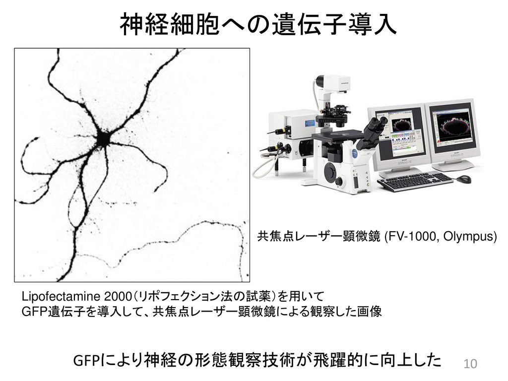 GFPにより神経の形態観察技術が飛躍的に向上した