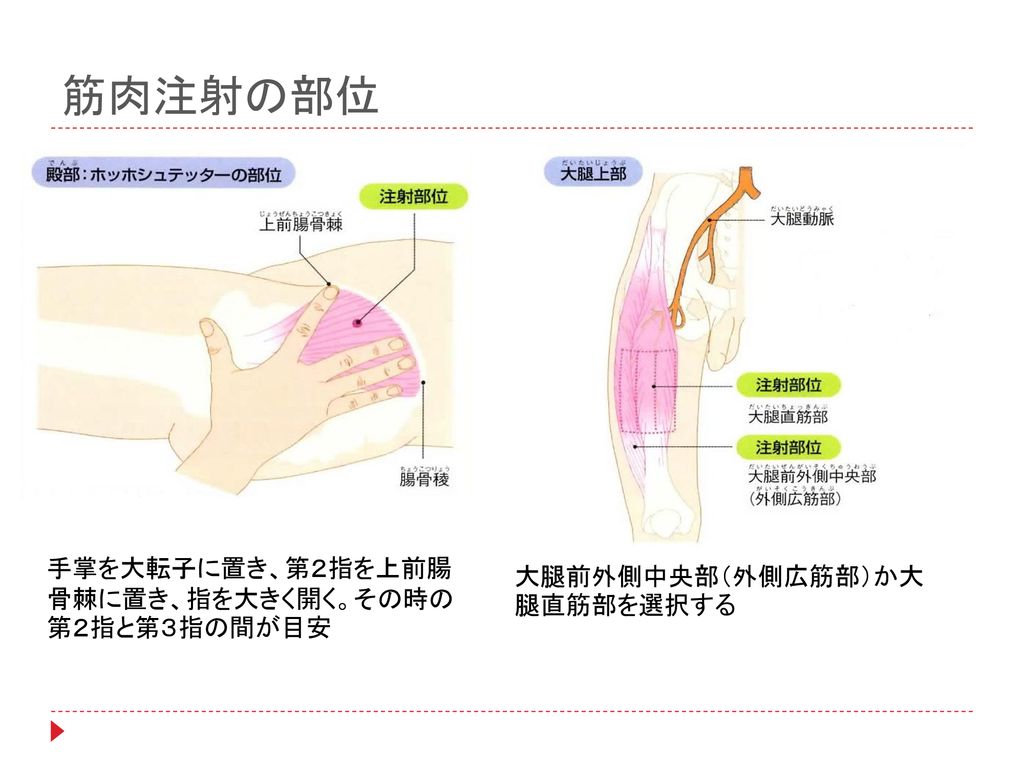 筋肉注射の部位 手掌を大転子に置き、第２指を上前腸骨棘に置き、指を大きく開く。その時の第２指と第３指の間が目安