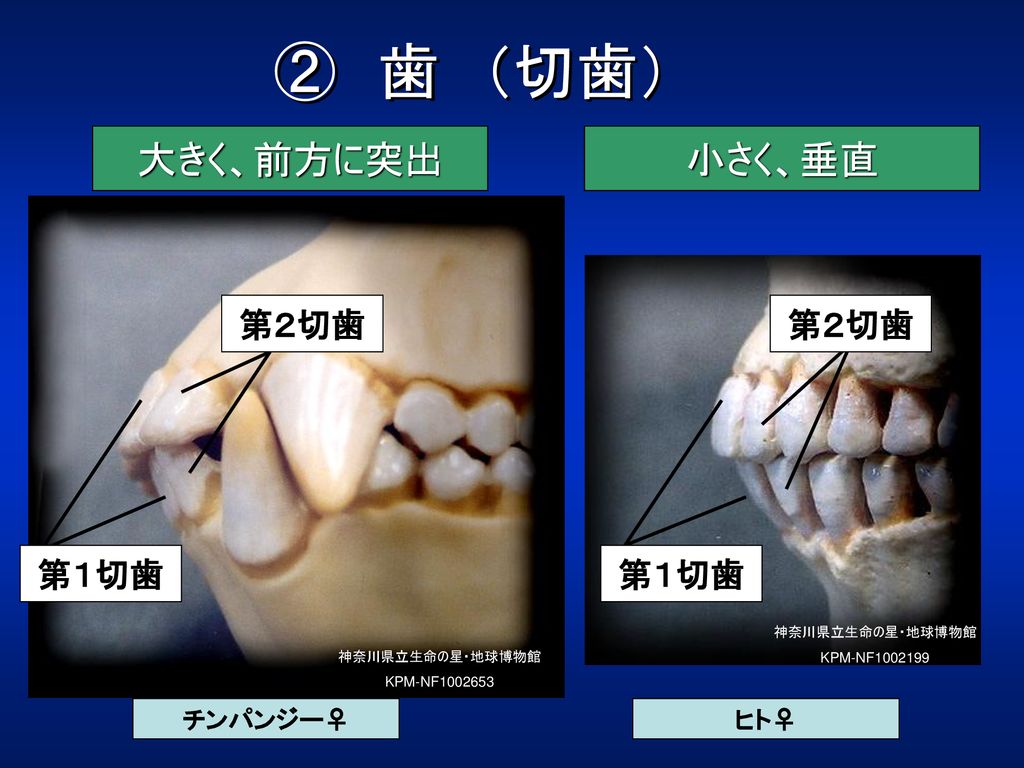 ② 歯 （切歯） 大きく、前方に突出 小さく、垂直 第２切歯 第１切歯 チンパンジー♀ ヒト♀