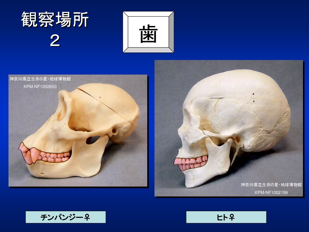 歯 観察場所 ２ チンパンジー♀ ヒト♀ 歯を示します。上下の顎の歯槽という孔に立っています。 神奈川県立生命の星・地球博物館
