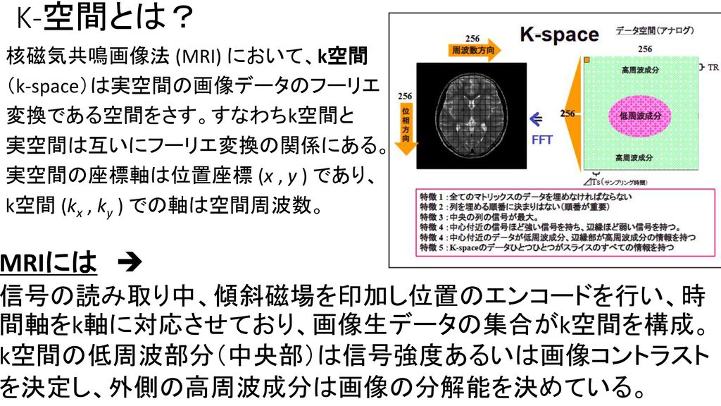 MRI検査スピード化 （疎明に映すことと併用されれば、多数の救命に） - ppt download