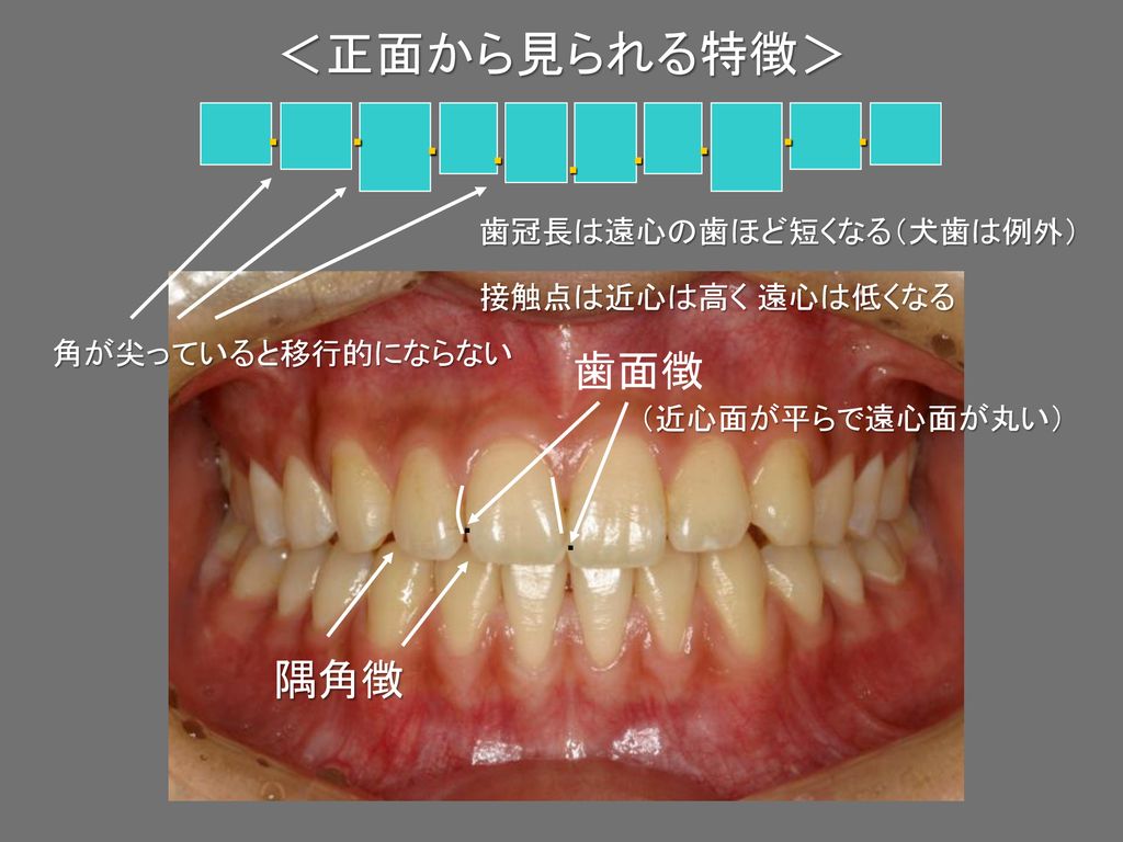 ＜正面から見られる特徴＞ 歯面徴 隅角徴 ・ 歯冠長は遠心の歯ほど短くなる（犬歯は例外） 接触点は近心は高く 遠心は低くなる