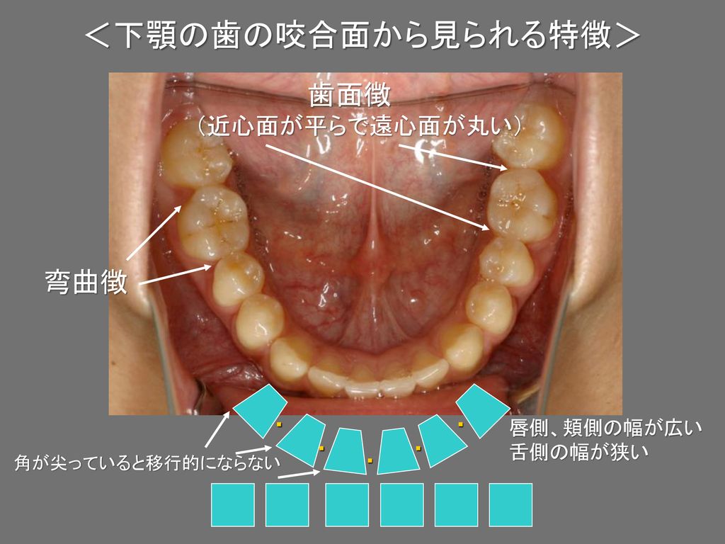 ＜下顎の歯の咬合面から見られる特徴＞ 歯面徴 弯曲徴 （近心面が平らで遠心面が丸い） ・ 唇側、頬側の幅が広い 舌側の幅が狭い