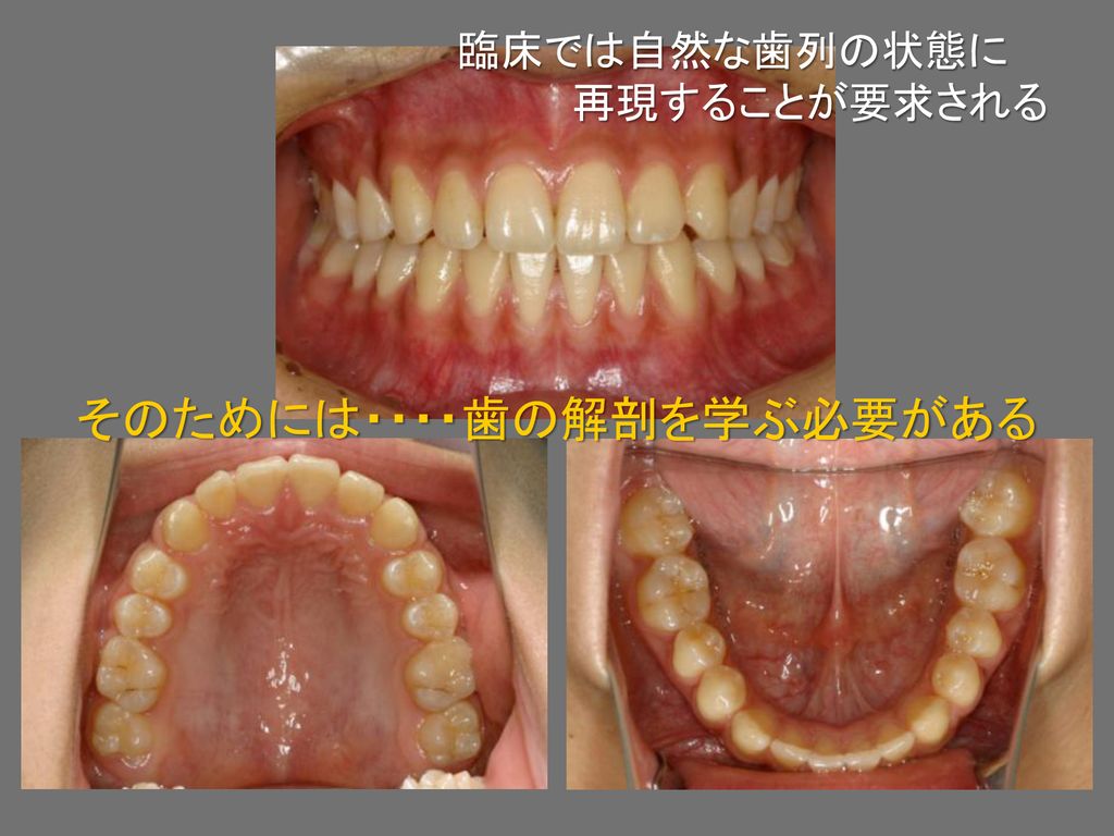 臨床では自然な歯列の状態に 再現することが要求される