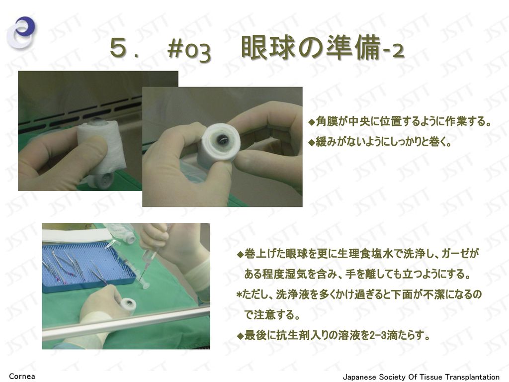 角膜 Cornea 日本組織移植学会 角膜チーム Ppt Download