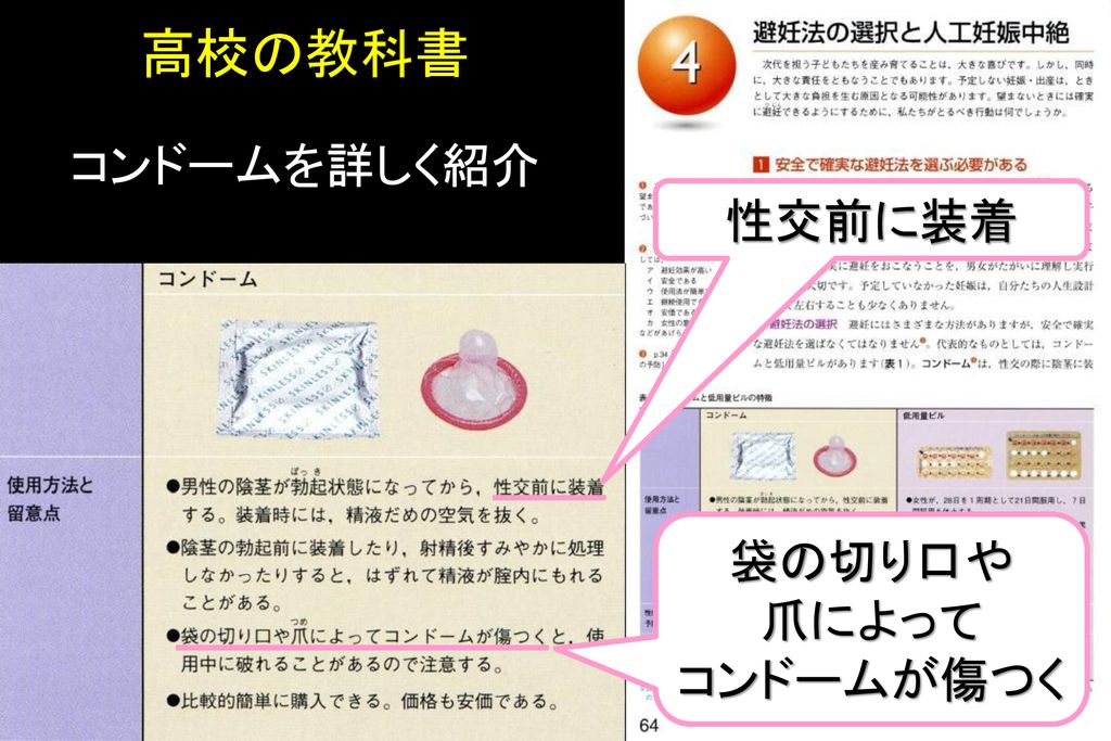 高校の教科書 コンドームを詳しく紹介 性交前に装着 袋の切り口や 爪によって コンドームが傷つく