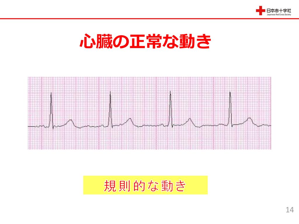 心臓の正常な動き 規則的な動き 14 これは心臓の正常な動きを表した心電図のデータです。
