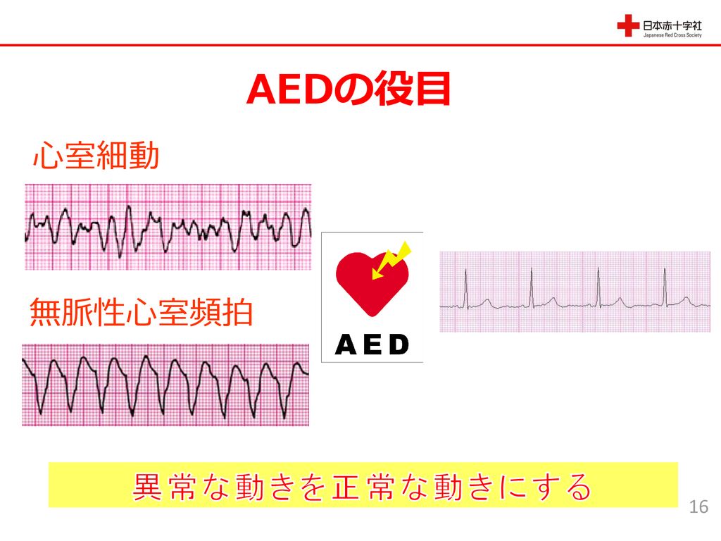AEDの役目 心室細動 無脈性心室頻拍 異常な動きを正常な動きにする 16