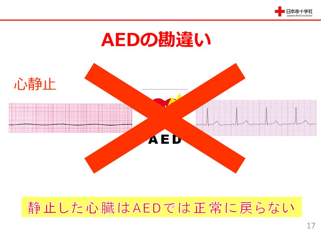 AEDの勘違い 心静止 静止した心臓はAEDでは正常に戻らない 17