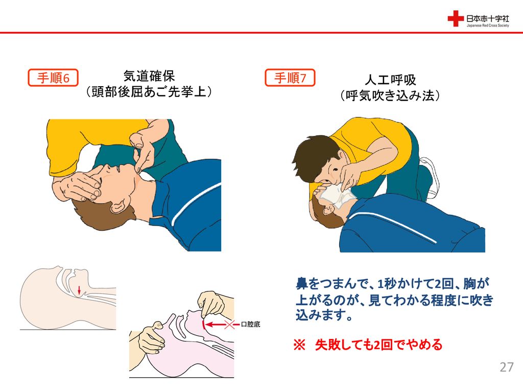27 気道確保 （頭部後屈あご先挙上） 手順6 手順7 人工呼吸 （呼気吹き込み法）