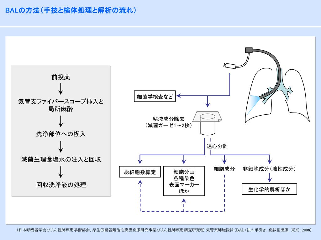 気管支肺胞洗浄 Bronchoalveolar lavage：BAL - ppt download