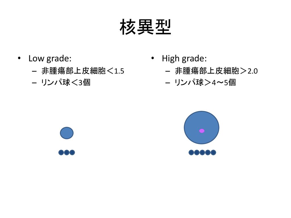 核異型 Low grade: 非腫瘍部上皮細胞＜1.5 リンパ球＜3個 High grade: 非腫瘍部上皮細胞＞2.0 リンパ球＞4～5個