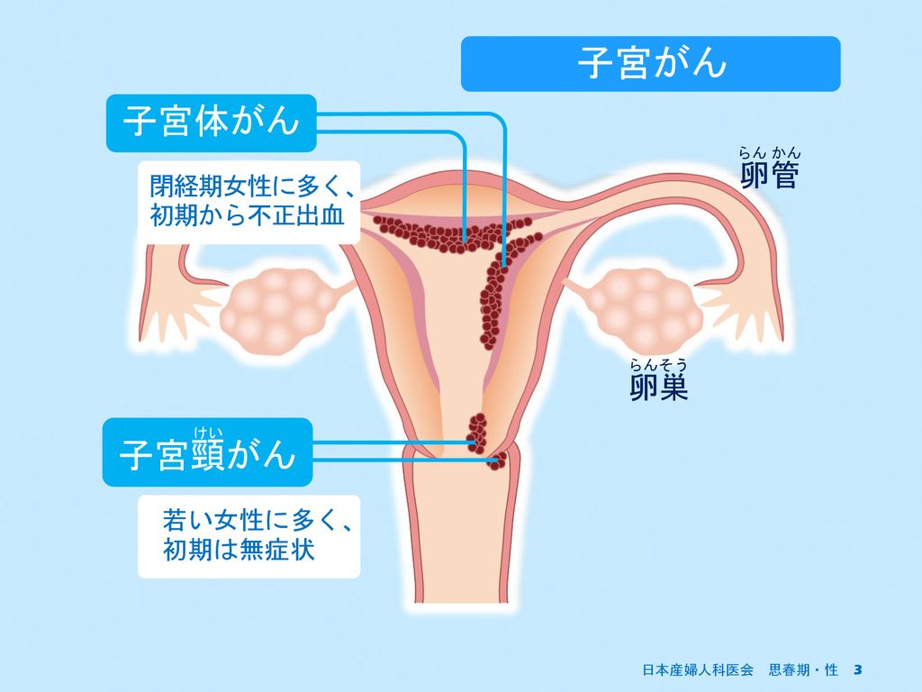 公益社団法人 日本産婦人科医会女性保健部 Ppt Download