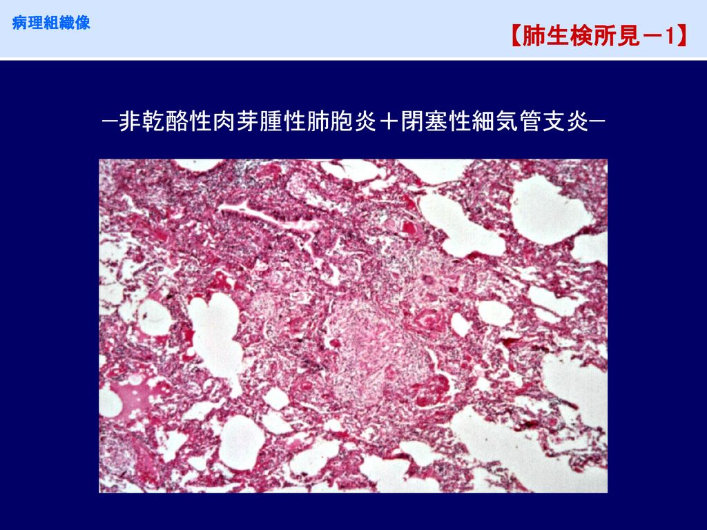 病理解説 染色1 膠原線維 弾性線維を対象とする染色 おるてぃのひとりごと