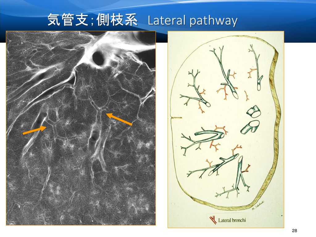 気管支；側枝系 Lateral pathway