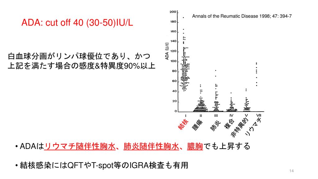 ADA: cut off 40 (30-50)IU/L 白血球分画がリンパ球優位であり、かつ 上記を満たす場合の感度&特異度90%以上