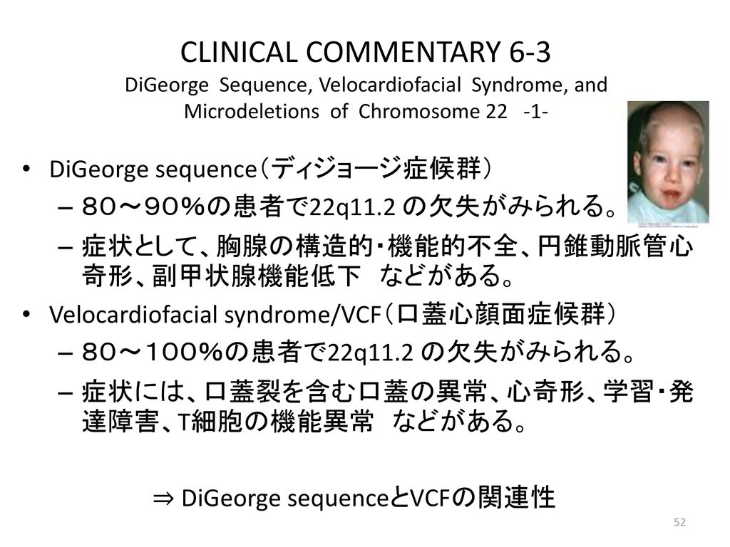 CLINICAL COMMENTARY 6-3 DiGeorge Sequence, Velocardiofacial Syndrome, and Microdeletions of Chromosome